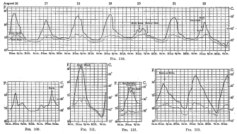Figs. 109-113—Temperature curves for locations in the
montaña, July and August, 1911. The curves are based on hourly readings
with interpolated readings for such critical occurrences as the
appearance of cloud or rain. Dry bulb readings are shown by solid lines,
wet bulb by dotted lines, and breaks in the continuity of the
observations by heavy broken lines. Fig. 109 is for Pongo de Mainique,
August 20 and 21; Fig. 110 for Yavero; Fig. 111 for Santo Anato, August
11 and 12; Fig. 112 for Sahuayaco, August 20, and Fig. 113 for Santa
Ana, July 30 to August 1.